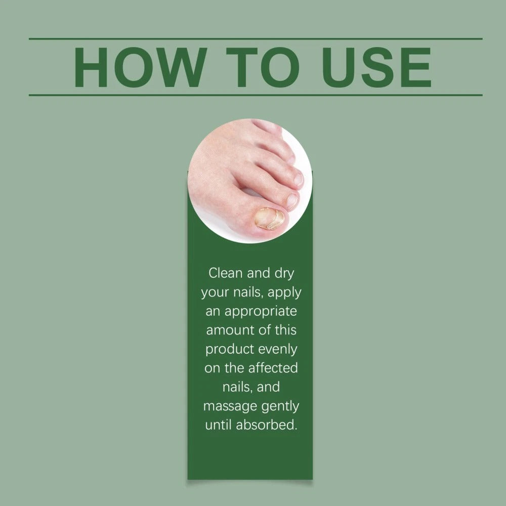 The Anti-Fungus Nail Pen™ - Kills Finger & Toe-Nail Fungus, Infection & Odour Fast. Restores Healthy, Clean Nails